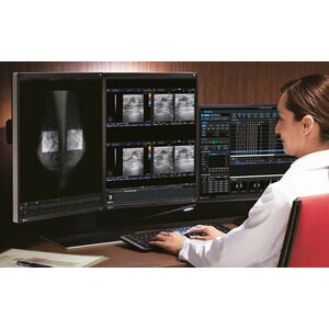  3MP RX360-BK DUAL LINK DVI